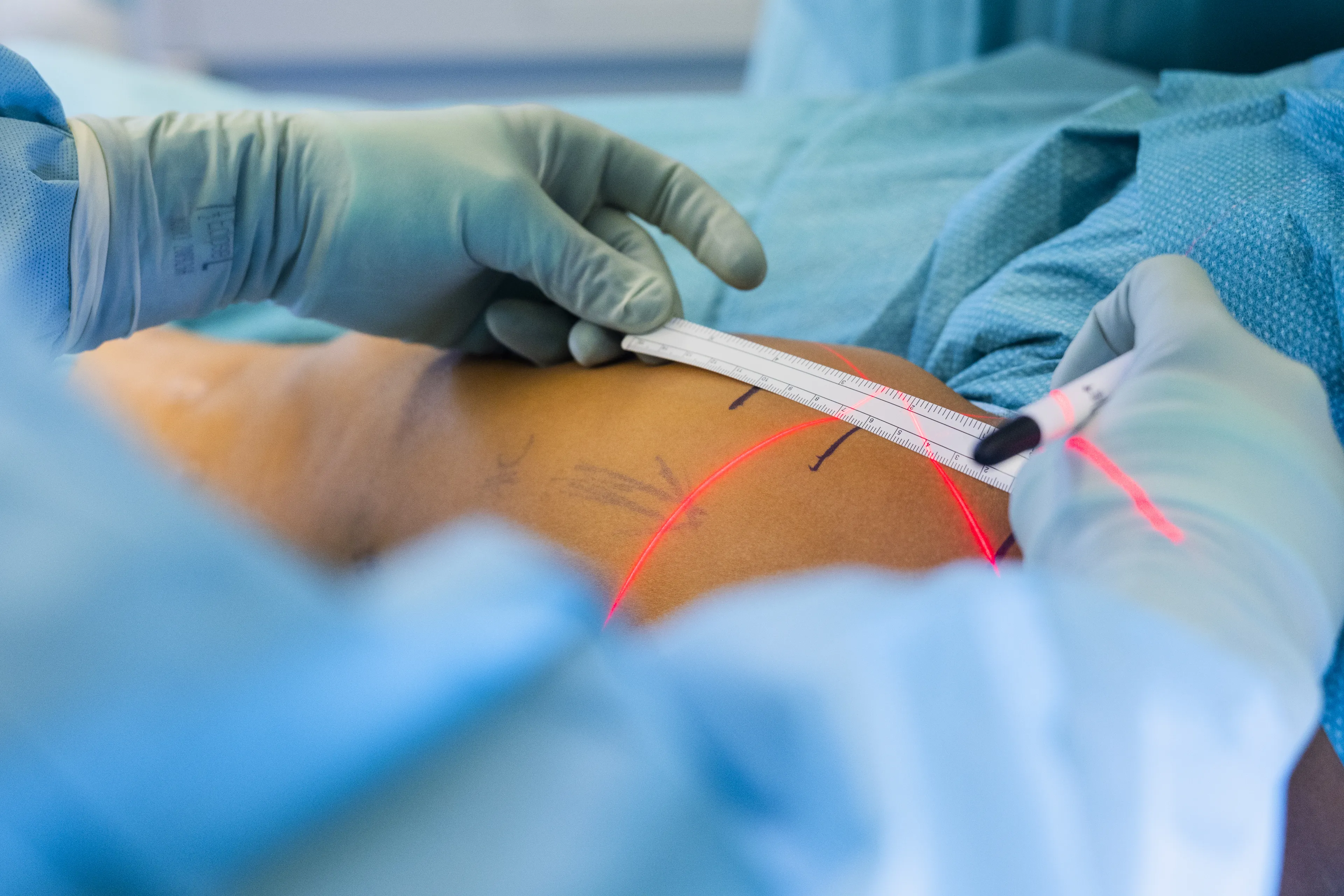 Kirurg måler hofteben