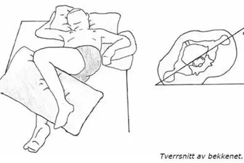 Illustrasjon av liggestilling i seng 30 graders vinkel