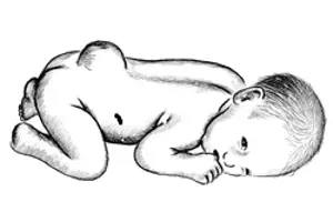 Illustrasjon av nyfødt med ryggmargsbrokk
