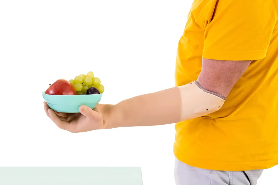 Person med armprotese holder skål med frukt