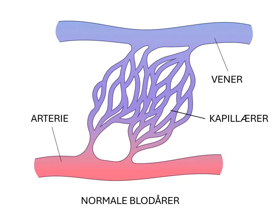 Normale blodårer med vener, kapillærer og arterie