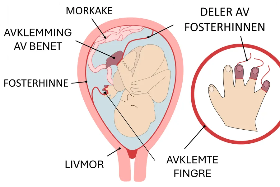 Diagram, skjematisk